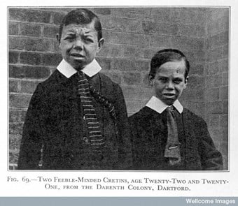 "Two cretins" From: Heredity in Man By Reginald Ruggles Gates, 1929. Photographs of disabled people were often used to show 'racial degeneration' in eugenicist texts.